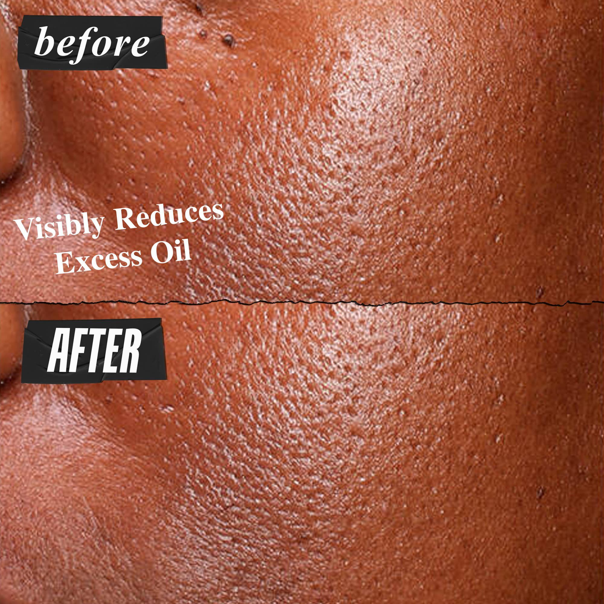 Fotografie Inainte și După cu serul Kiehl's Ultra Pure High-Potency reducand vizibil excesul de sebum