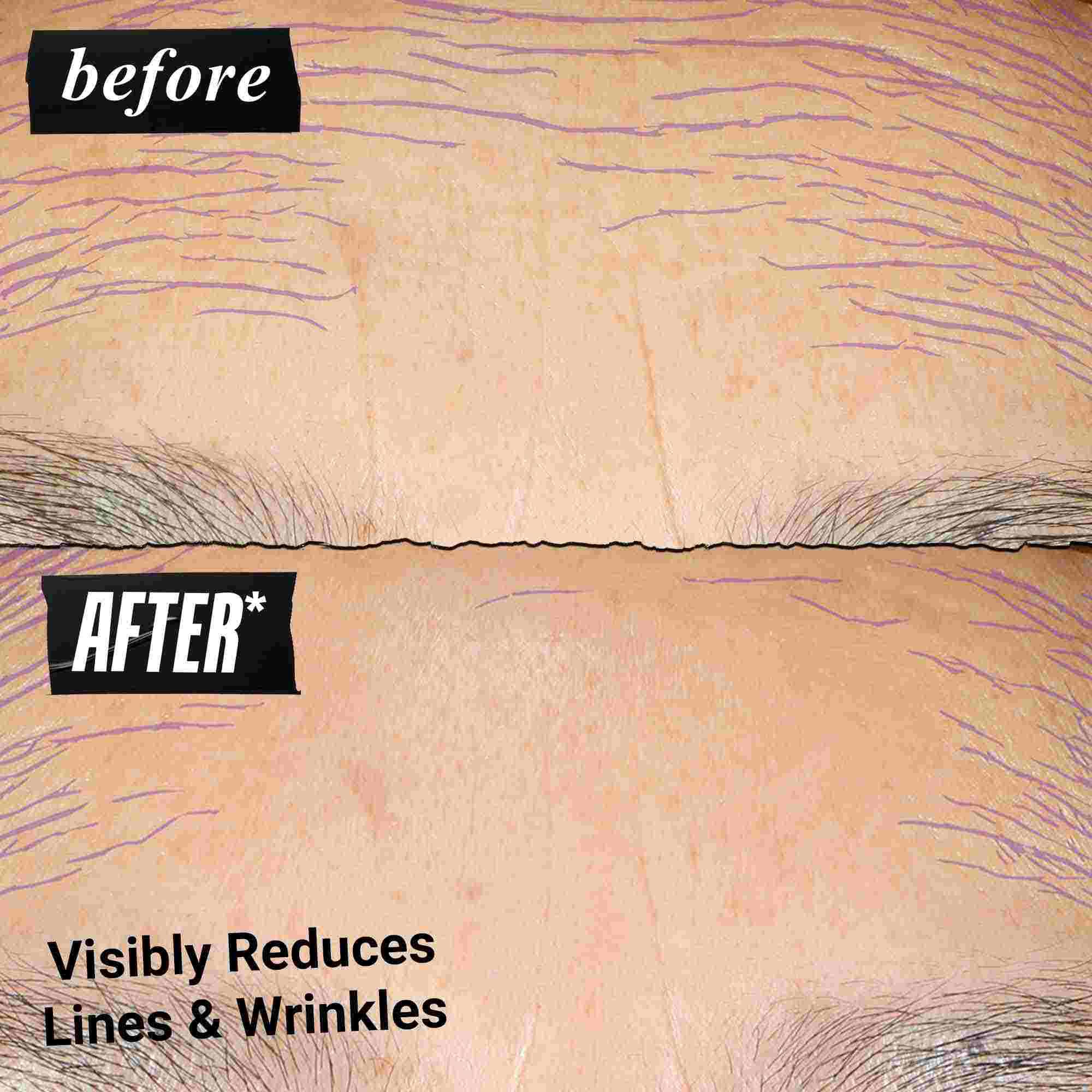 Fotografie Inainte și După - Kiehl's Retinol Skin Renewing Daily Microdose ajută la imbunătățirea nuanței și texturii pielii