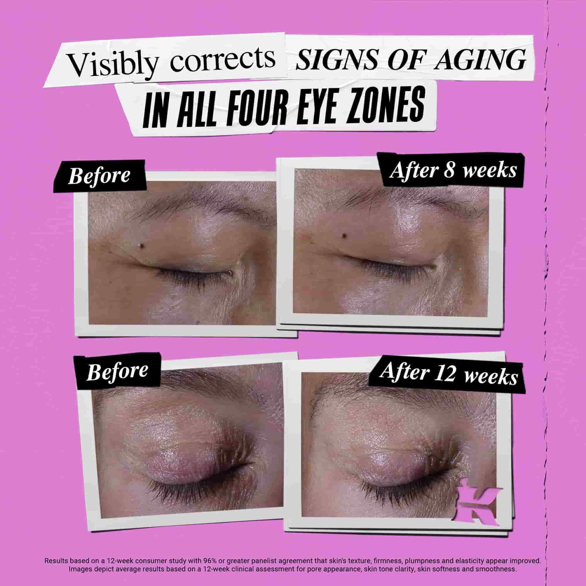 Fotografie Inainte și După pentru Kiehl's Super Multi-Corrective Eye Zone Treatment care corectează semnele imbătranitului