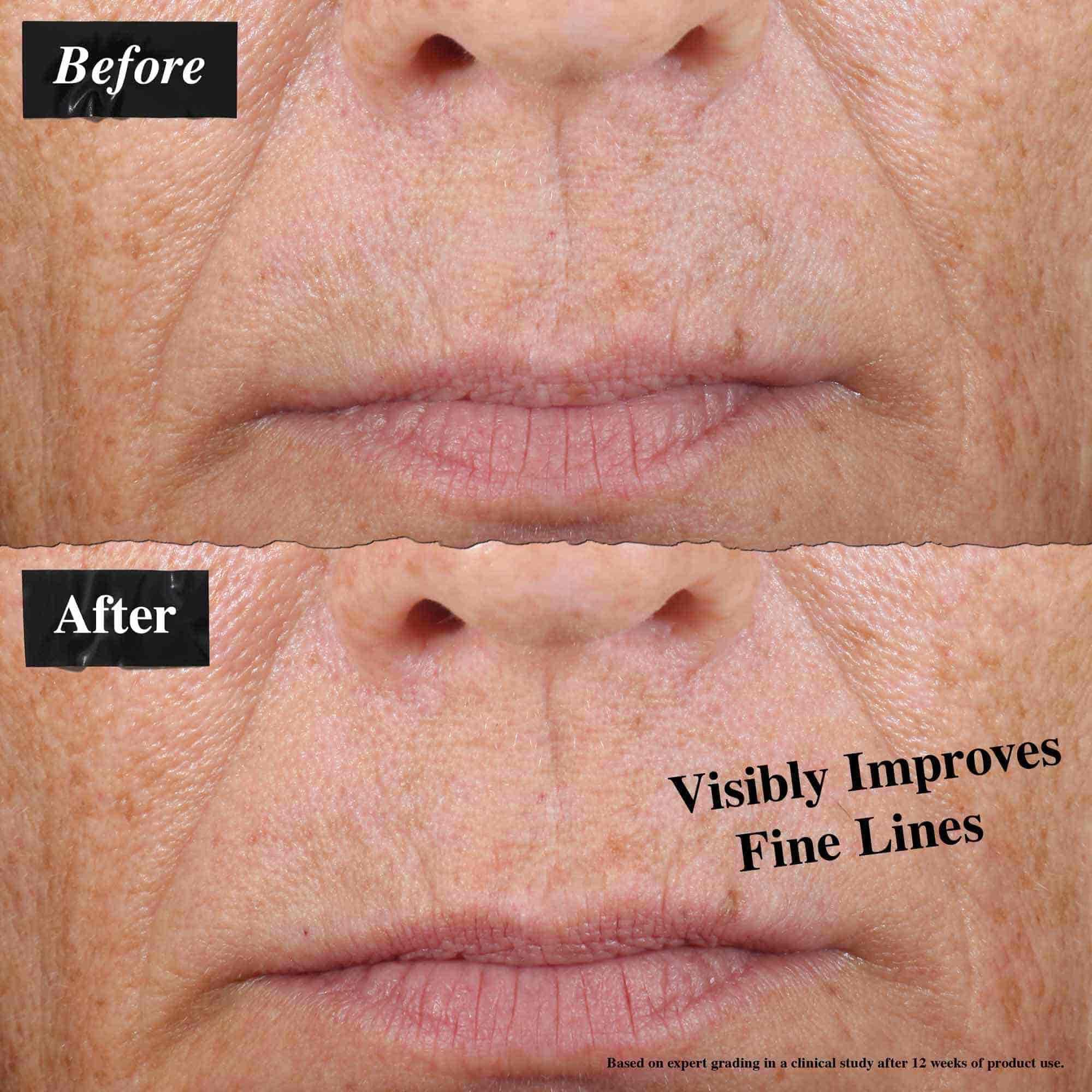 O comparație inainte și după care arată linii fine vizibil reduse după utilizarea uleiului facial Midnight Recovery Concentrate.