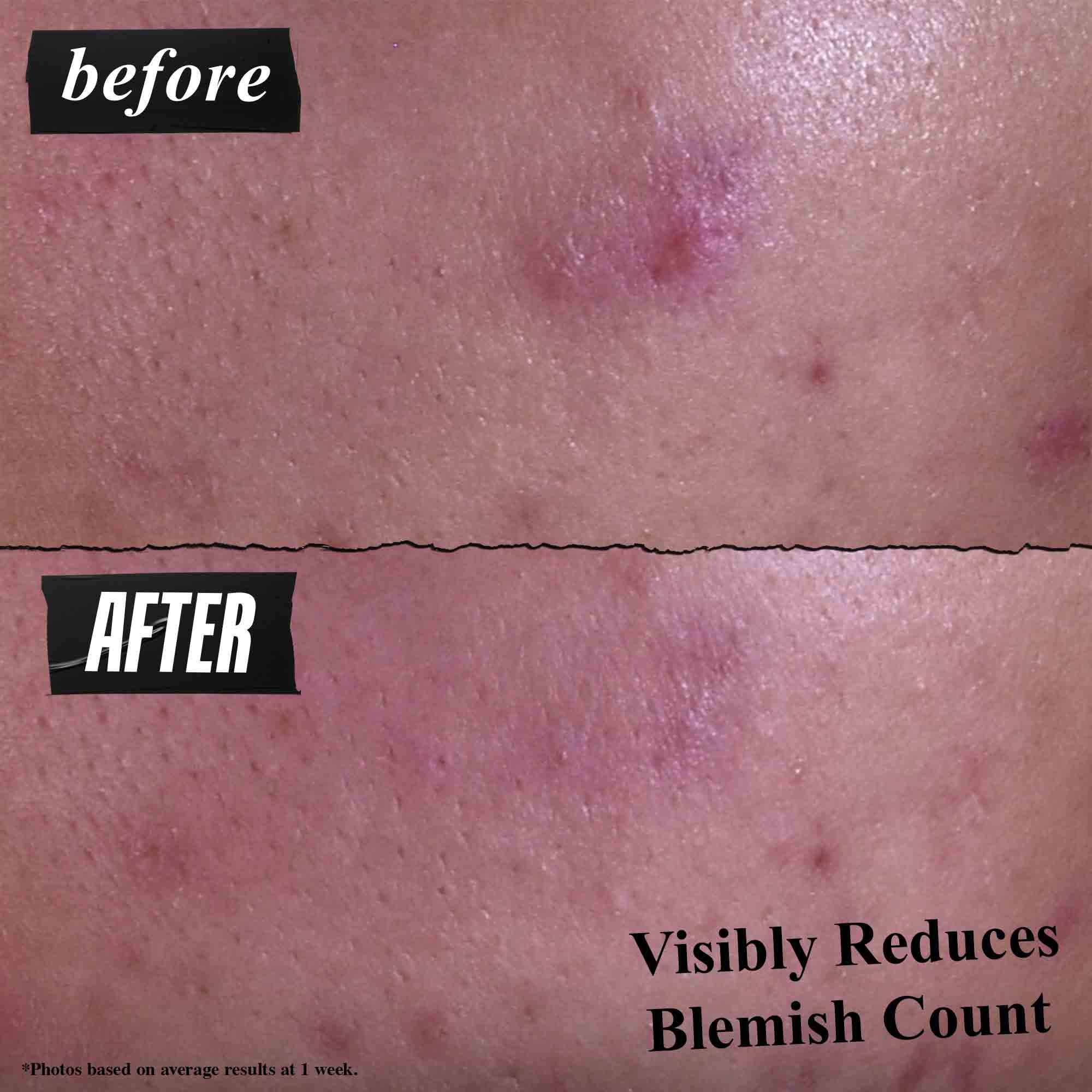Gently Effective Blemish-Targeting Cleansing Paste - Produs pentru curățarea feței cu textură de pastă și Acid Salicilic