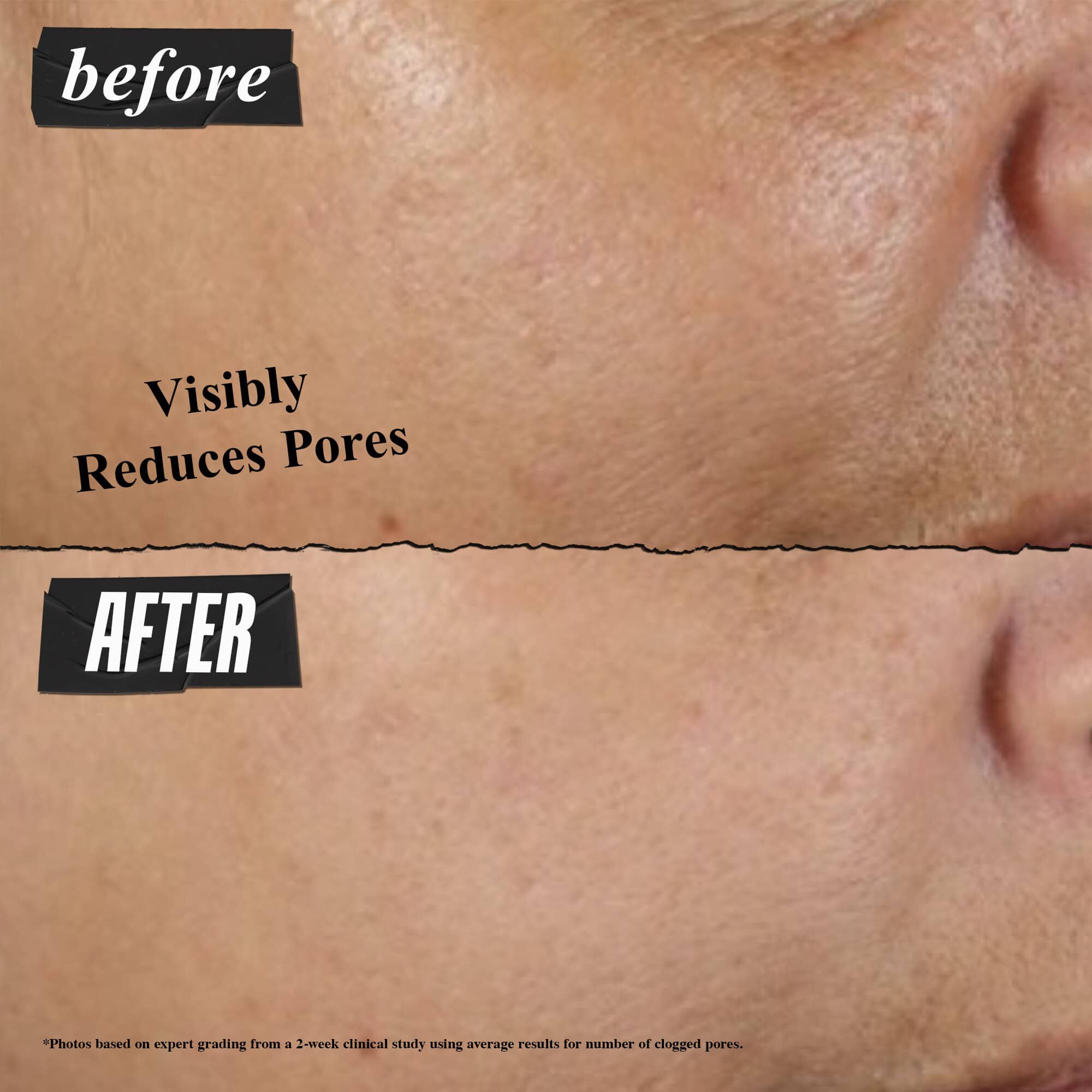 Rare Earth Pore-Minimizing Clay Mask