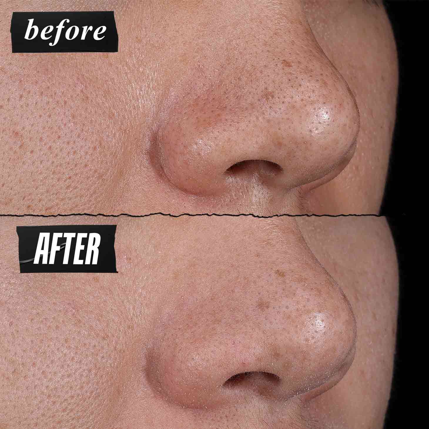 Fotografie Inainte și După - Kiehl's Rare Earth Deep Pore Cleansing Masque reduce vizibil porii