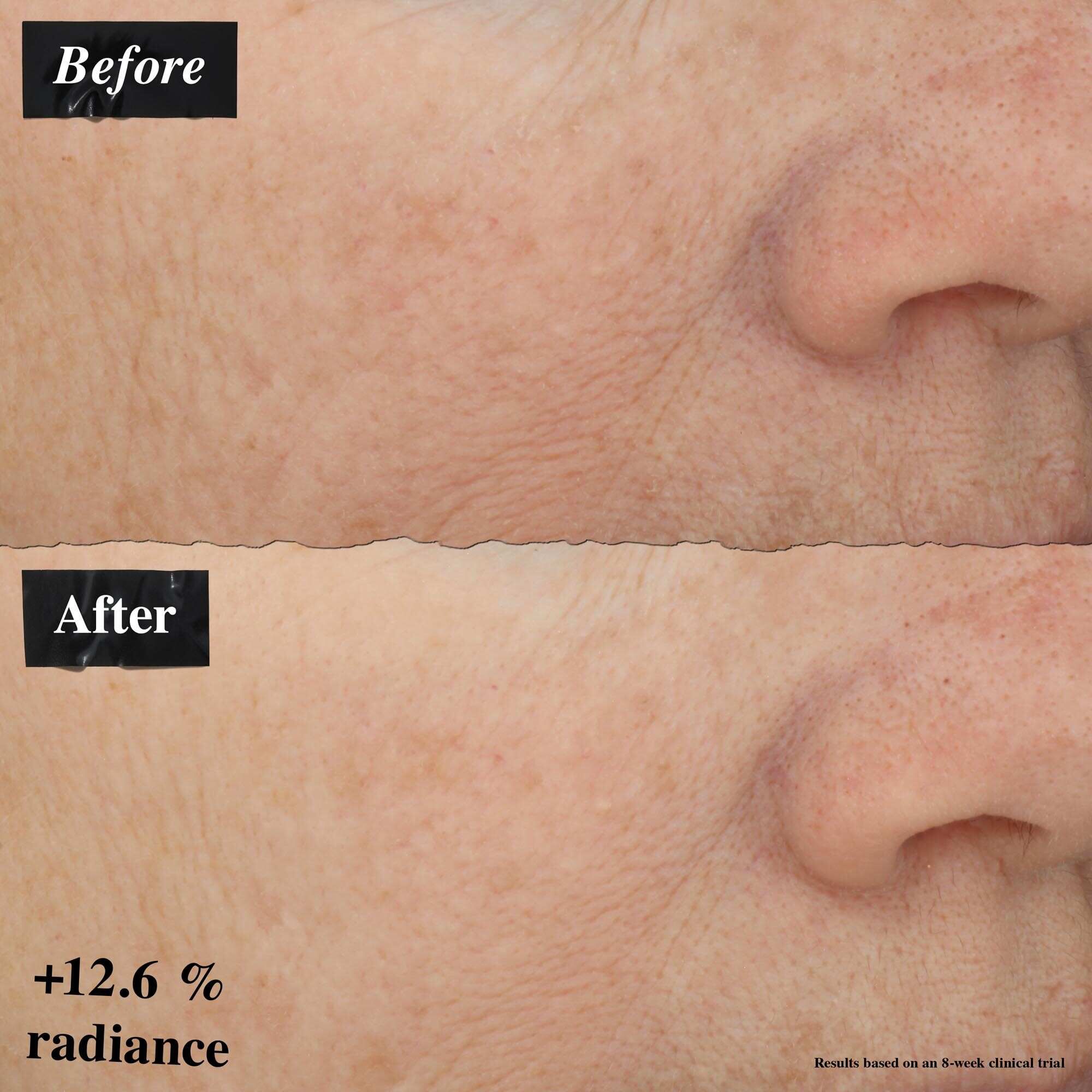 O comparație de imagini inainte și după care arată o imbunătățire a roșeții pielii după utilizarea Powerful-Strength Line-Reducing Concentrate.