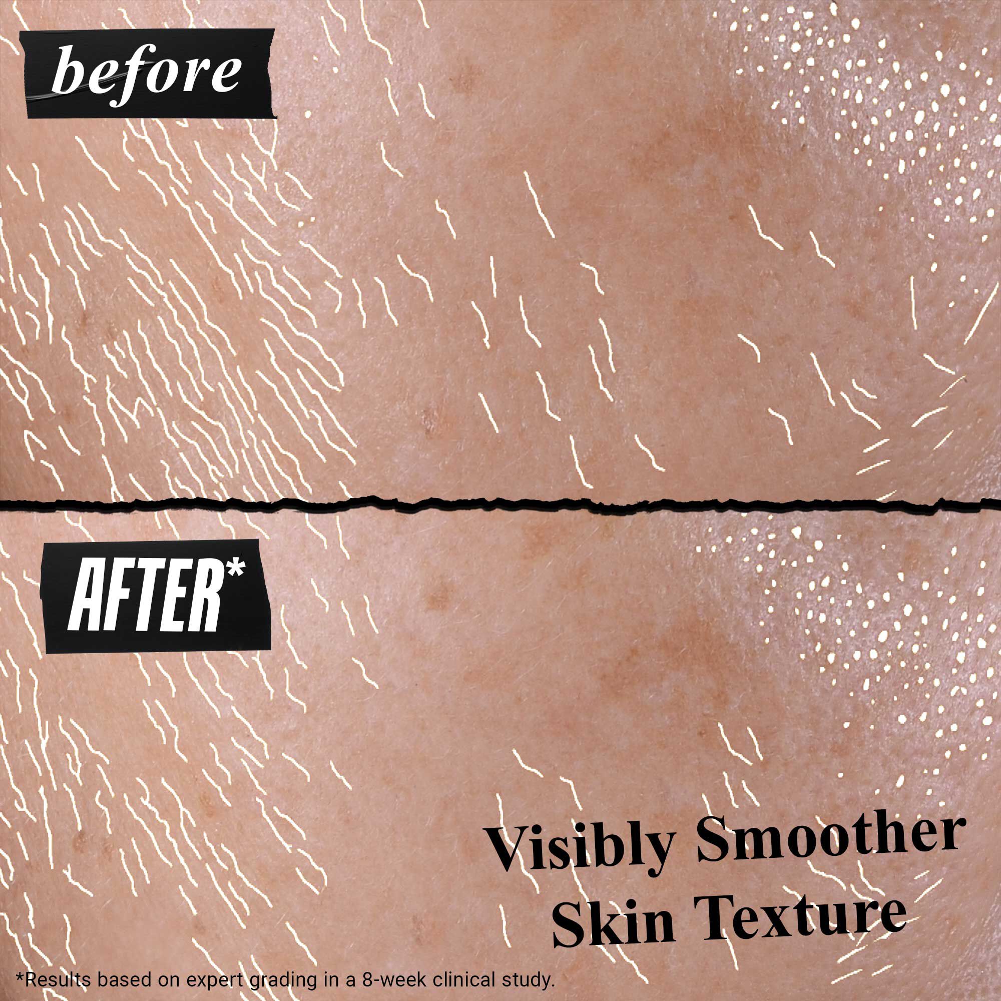 Imagini cu rezultate inainte/după ale serumului UV Better Screen