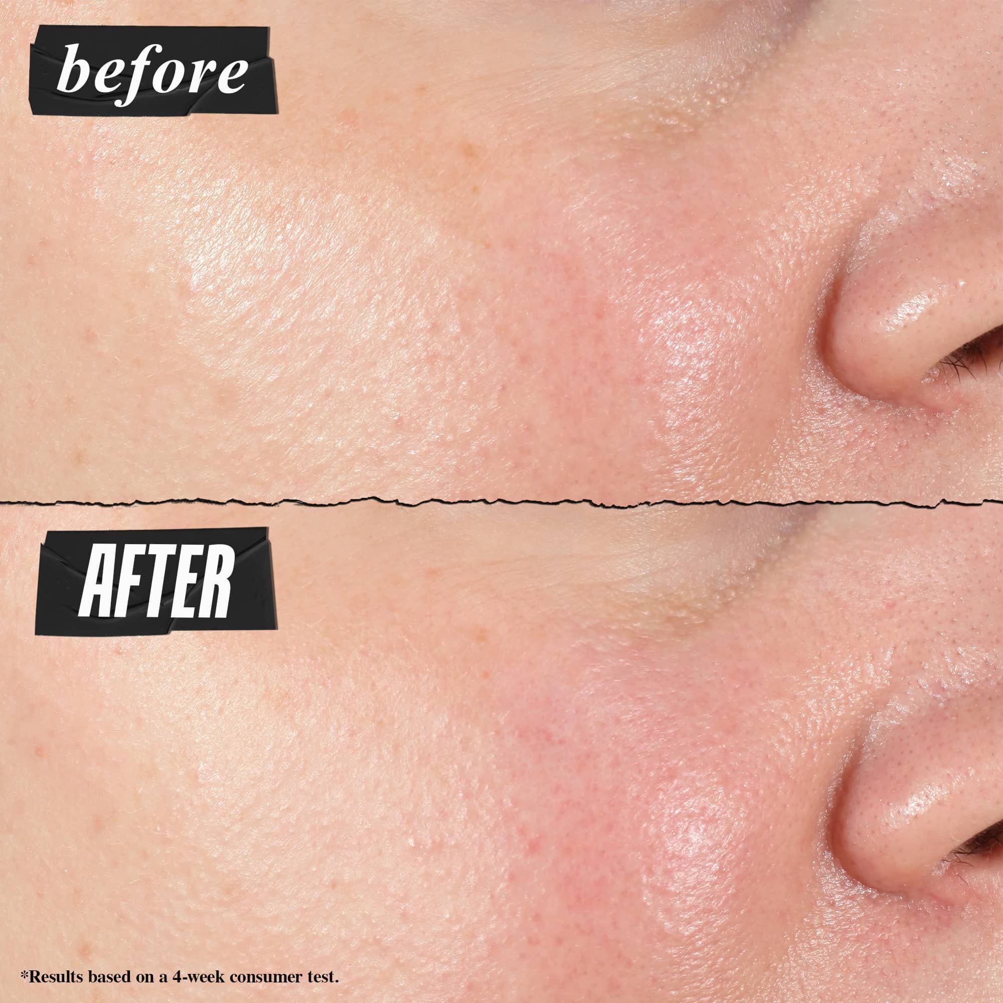 Fotografie Inainte și După - Kiehl's Hydro Plumping Serum Concentrate reduce vizibil porii