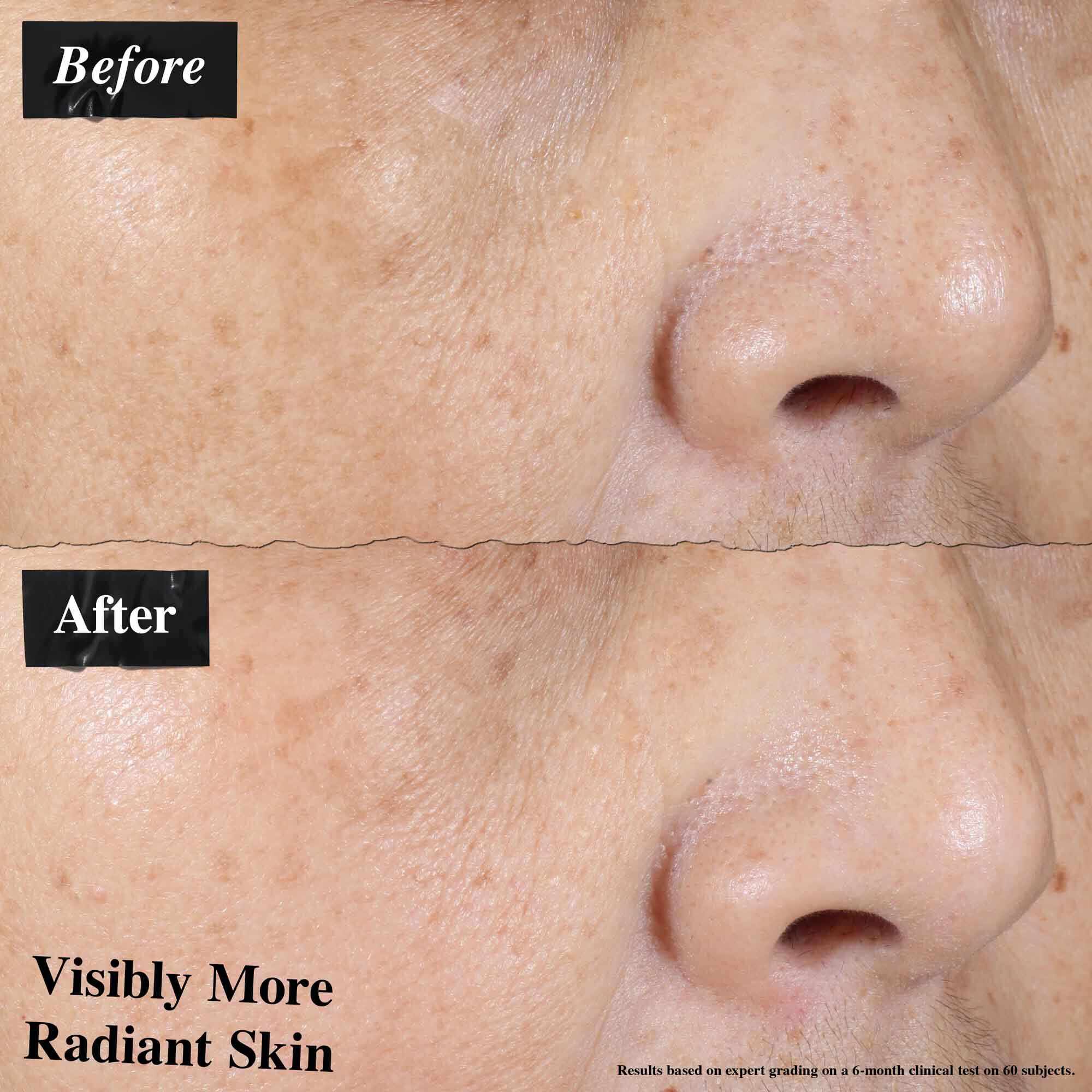 Comparație inainte și după care arată roșeața pielii vizibil redusă după utilizarea Ultra-Light Daily UV Defense.