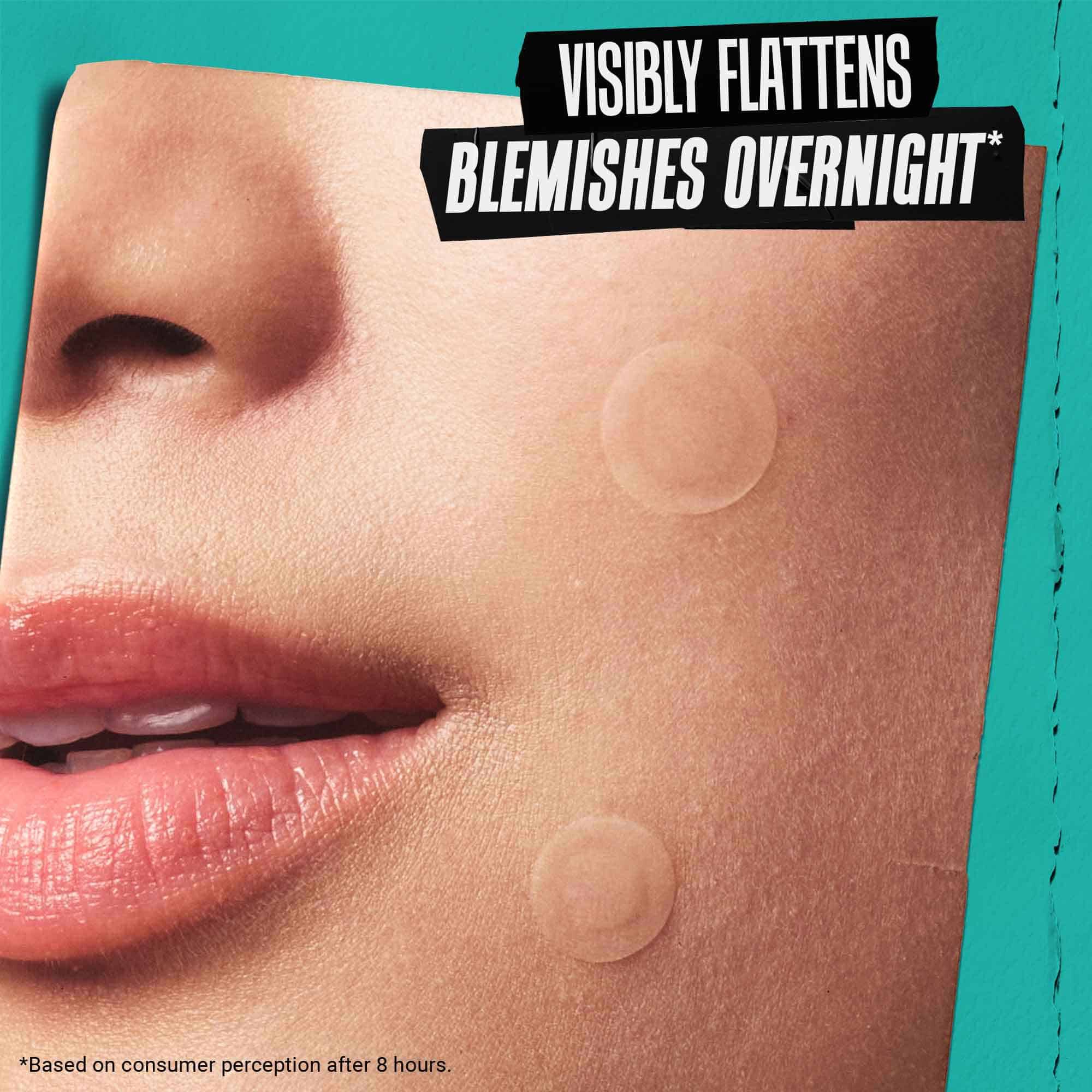 Truly Targeted Overnight Blemish Patch - Plasturi anti-imperfecțiuni