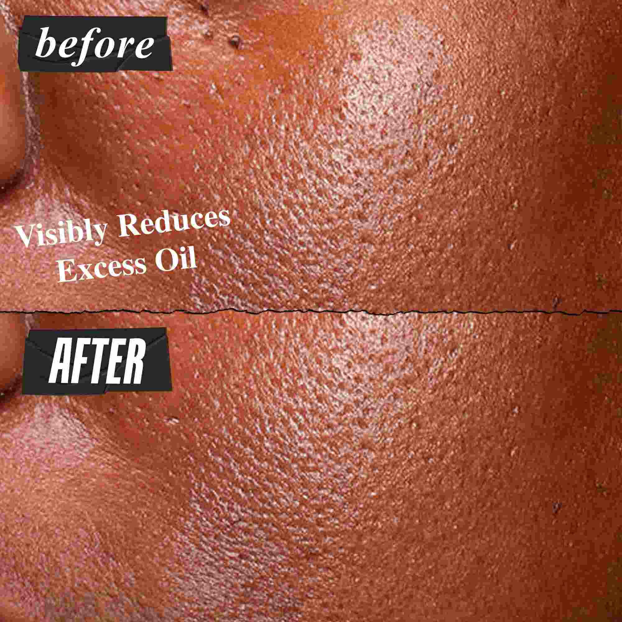 Fotografie Inainte și După cu serul Kiehl's Ultra Pure High-Potency reducand vizibil excesul de sebum