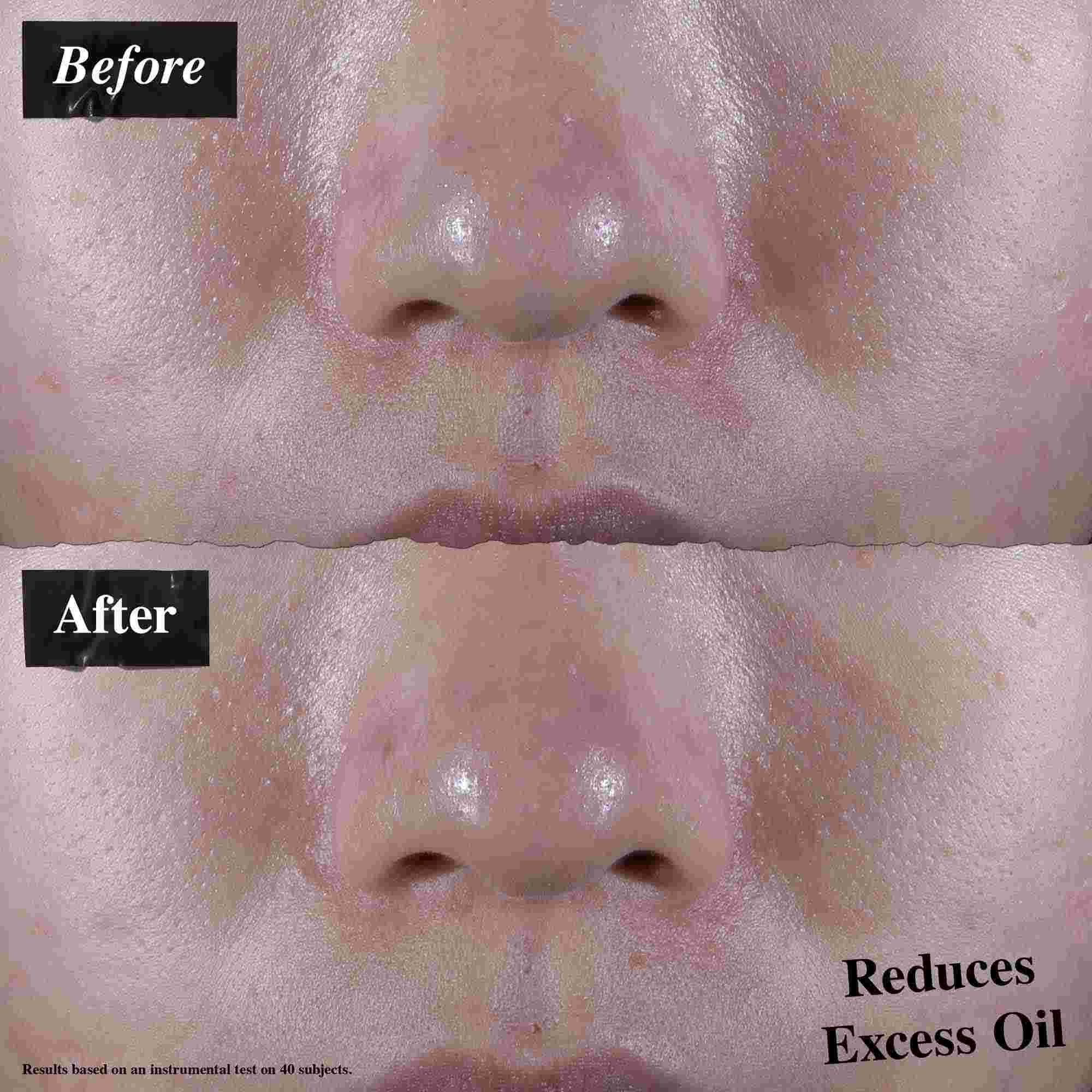 Comparație inainte și după care arată reducerea excesului de sebum după utilizarea Ultra Facial Oil-Free Gel Cream.