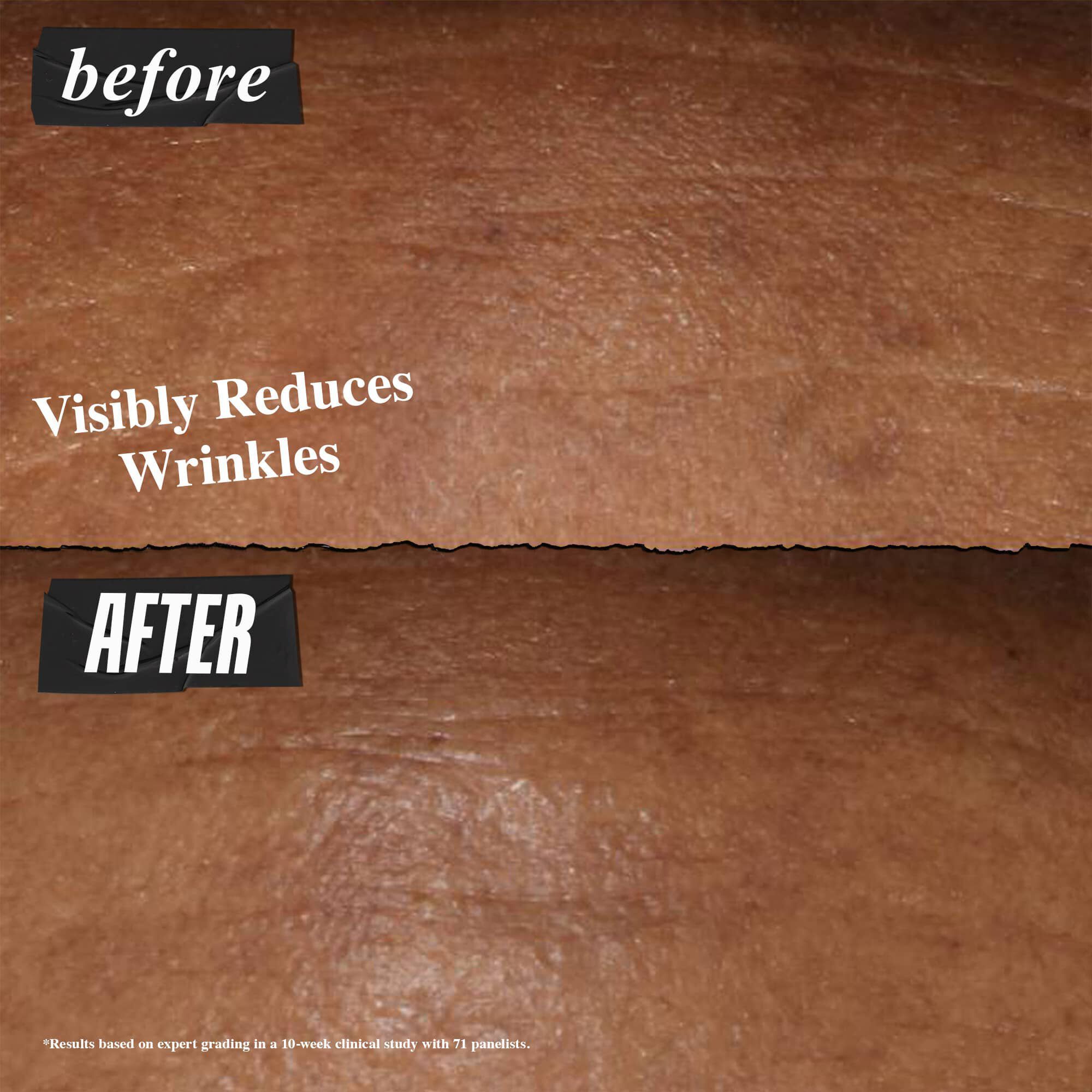 Fotografie Inainte și După - serul de noapte Kiehl's Retinol Fast Release reduce vizibil ridurile