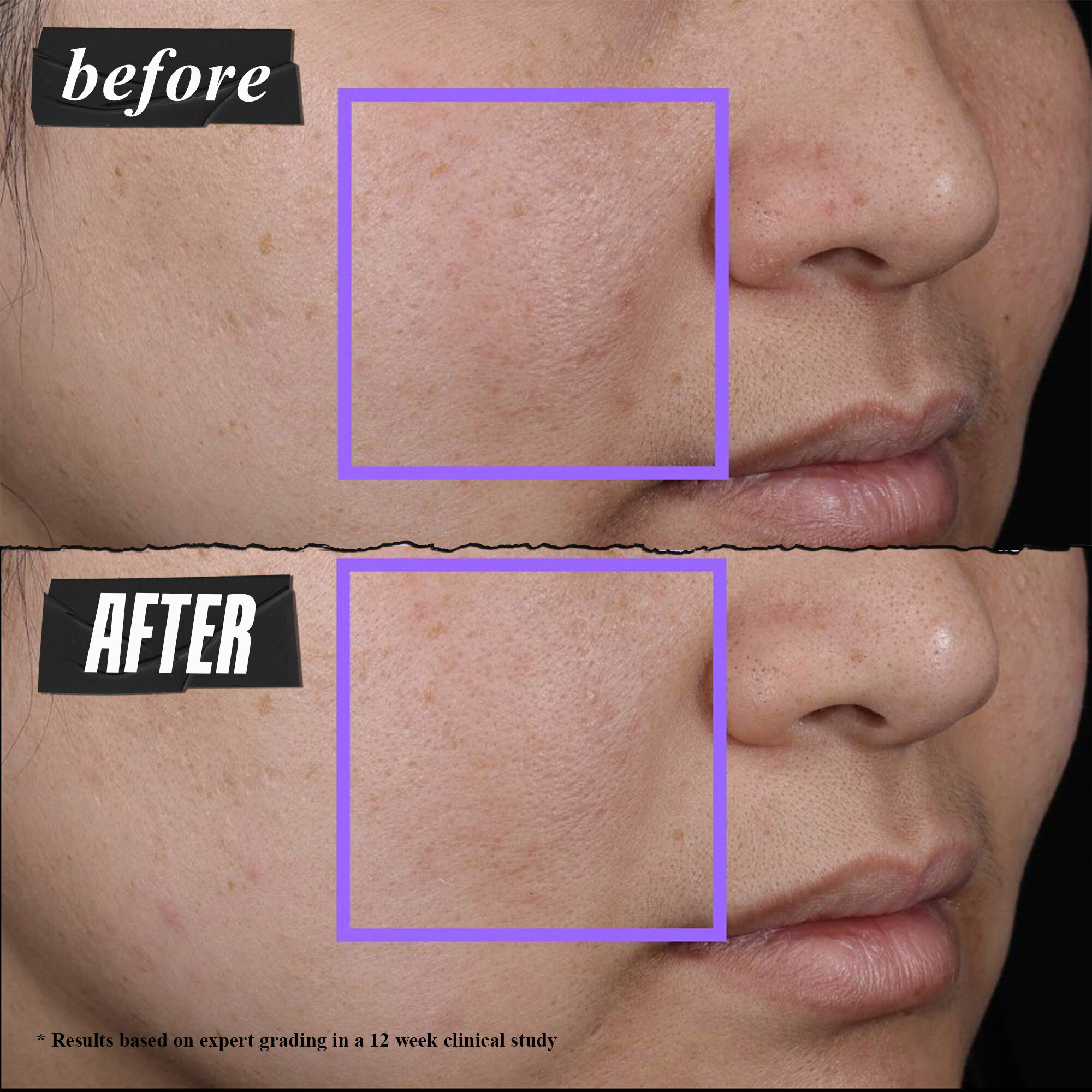 Clearly Corrective™ Clarity-Activating Soothing Emulsion - emulsie calmantă, ce redă claritatea tenului