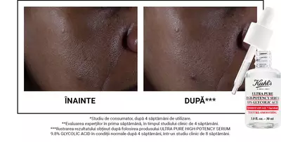 Before and after comparison of skin texture, showing improvement after four weeks of using Kiehl's Ultra Pure Glycolic Acid serum, with a dropper bottle of the serum featured in the image.