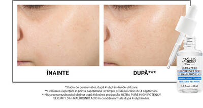 Before and after images showing skin improvement over four weeks, with a dropper bottle of Kiehl's Ultra Pure High-Potency Serum displayed below.