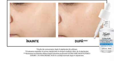 Before and after images showing skin improvement over four weeks, with a dropper bottle of Kiehl's Ultra Pure High-Potency Serum displayed below.